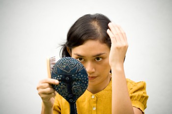 Typy plešatenia: Telogénne efluvium spôsobuje šok a stres. Takže radšej relaxujte!